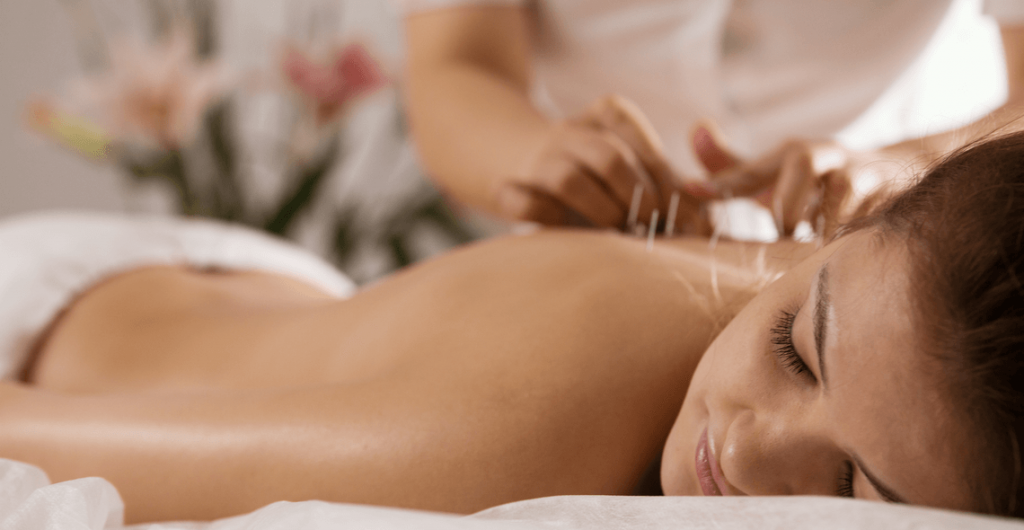 Medical Acupuncture